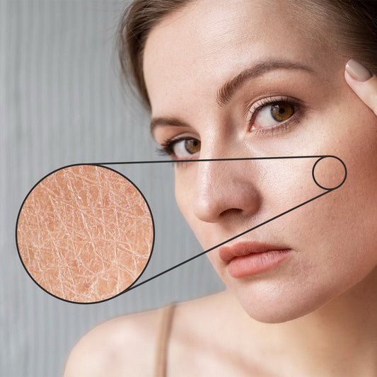 Say Goodbye to Dry Skin: Effective Tips for a Radiant Complexion - Skin Chemistry Official 